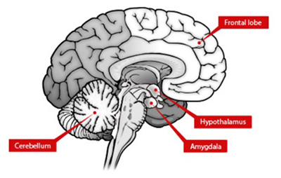 Examine the four parts of the brain impacted by the zombie virus.